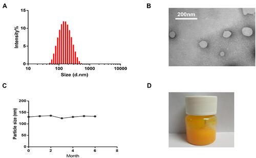 Figure 1 Characterization of Cel Nio. (A) Particles distribution of Cel Nio; (B) TEM of Cel Nio (The bar is 200 nm); (C) The stability of Cel Nio of 6 months; (D) The photograph of Cel Nio gel.