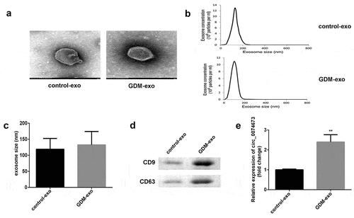 Figure 1. The expression of circ_0074673 is increased in the exosomes isolated from the umbilical cord blood of patients with GDM. (a) The morphology of the exosomes was visualized by TEM. (b) The size of the exosomes was detected by NTA. (c) The size of the exosomes was quantified. (d) The levels of CD9 and CD63 were determined by western blotting. (e) The expression of circ_0074673 was detected by qPCR. Each experiment was repeated in three times. **P < 0.01