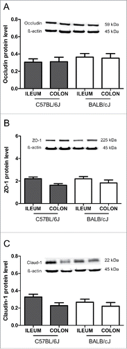 Figure 4. Tight junction protein levels in healthy mice. Immunoblot analysis of tight protein levels for occludin (A), zonula occludens-1 (ZO-1) (B) and claudin-1 (C) are shown for the ileum and colon in C57BL/6J and BALB/cJ mice. The protein levels were normalized to β-actin. Statistics: mean ± SEM, N = 16–24 per group.