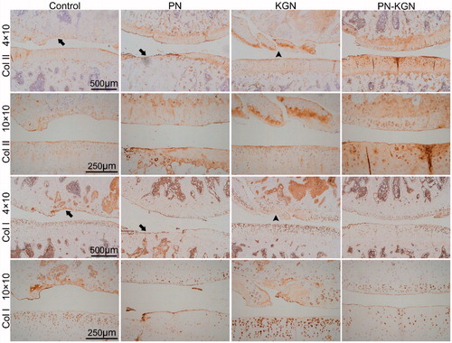 Figure 6. Immunohistochemistry staining for collagen II (Col II) and collagen I (Col I) in Control group, PN group, KGN group and PN-KGN group at 12 weeks. Arrows: cartilage erosion and denudation, arrow heads: matrix vertical fissures. Bar = 500 µm or 250 µm.