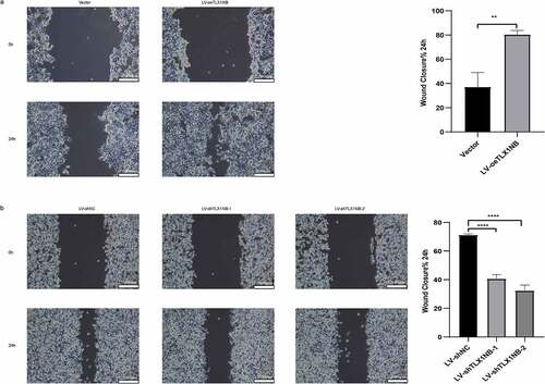 Figure 3. The effects of TLX1NB on wound healing of colon cancer cells in vitro. (a) Wound healing assays in HCT116 cells transfected with LV-oeTLX1NB or empty vector control. (b) Wound healing assays in SW620 cells transfected with LV-shTLX1NB-1, LV-shTLX1NB-2 or LV-shNC. **P < 0.01; ****P < 0.0001.