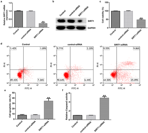 Figure 6. Effect of SIRT1-small interfering RNA (siRNA) on the apoptosis of cultured neurons. (a) mRNAexpression levels of SIRT1 in the transfected cells were evaluated using western blotting analysis. (b) Protein expression levels of SIRT1 in the transfected cells were determined using RT-qPCR analysis. (c) Viability of the transfected cells was detected using an MTT assay. (d and e) Flow cytometry analysis was used to detect the apoptosis of transfected cells. (f) Caspase 3 activity was determined. **P < 0.01 vs. control-siRNA. SIRT1, sirtuin 1; siRNA, small interfering RNA.