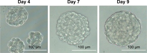 Figure 4 Light microscope images of mammospheres after incubation for 4, 7, and 9 days, respectively.Note: Scale bar: 100 μm, magnification: 200×.