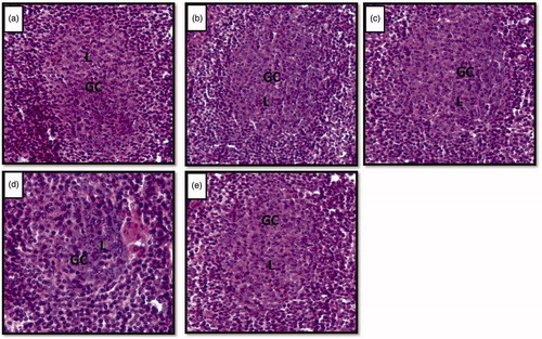 Figure 4. (a–e) Photomicrographs of cross sections of axillary lymph node showing lymphoid follicles. Note the shrinkage of germinal centers in stressed (d) rat compared to control (a), vehicle control (b), unstressed + Vacha extract (c) and stress + Vacha extract (e) treated rats. 200× H&E. GC: germinal centre; L: B lymphocytes.
