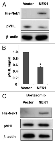 Figure 1. Overexpression of Nek1 leads to pVHL degradation. (A) HEK cells were transfected with Nek1-pcDNA3.1-Myc/His or empty vector to collect whole-cell lysate 36 h later for immunoblot analysis of pVHL, Nek1-Myc/His and β-actin. (B) Densitometric analysis of immunoblots. pVHL signal was normalized by β-actin signal in the immunblots from three experiments. (C) HEK cells were transfected with Nek1-pcDNA3.1-Myc/His or empty vector for 36 h and then treated with 100 nm Bortezomib for 4 h to collect whole-cell lysate for immunoblot analysis of VHL, Nek1-Myc/His and β-actin.