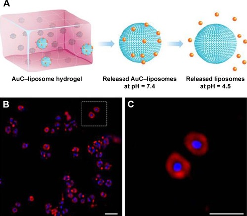 Figure 3 Gao et al synthesized hydrogel containing Au NP-stabilized liposomes for antimicrobial application (A) illustrations of hydrogel containing nanoparticle-stabilized liposomes for topical antimicrobial delivery; (B) bacteria incubated with AuC–liposome hydrogel (PEGDMA 0.8 vol%) at pH = 4.5; (C) a zoomed-in image of (B).Note: The scale bars in (B and C) represent 1 µm. Reproduced from Gao W, Vecchio D, Li J, et al. Hydrogel containing nanoparticle-stabilized liposomes for topical antimicrobial delivery. ACS Nano. 2014;8(3):2900–2907.Citation89
