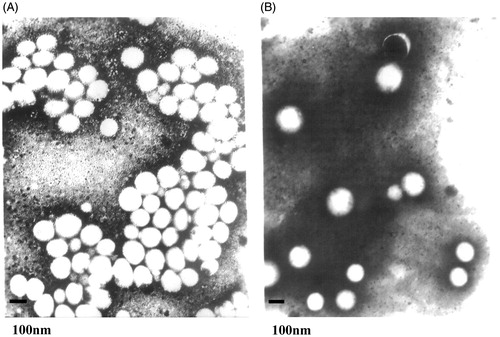 Figure 2. 50 000 × magnified TEM of normally prepared VIN-mPEG–PLA NPs.