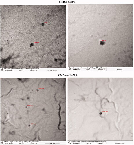 Figure 2. TEM images. Spherical NPs were displayed at 100 and 200 nm scale, empty CNPs and loaded nanoparticles with miR-219. The samples were loaded on mesh carbon films using JEM 1400 instrument.