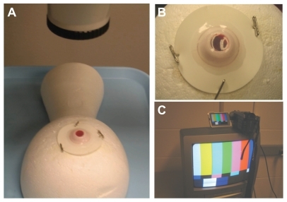 Figure 1 Operating microscope and digital recording setup. The VitRet eye is pinned to a Styrofoam head and centered under the operating microscope (A) with its rubber leaflets attached to the apparatus with pushpins (B). This is performed after the injection of 10% half-and-half cream/saline mixture into the synthetic eye. The operating microscope is connected to the digital recording device with a video output for observation and evaluation (C).