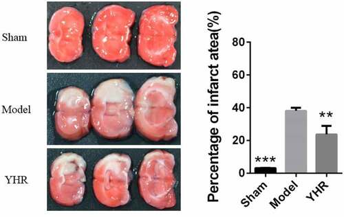 Figure 1. YHR inhibited the area of cardiac infarction. Heart cross section (left) and infarct area (right). Each group consists of three continuous cross sections of rat heart. The ratio of the infarct area to a single section X 100% was used as the infarct rate. The infarction rate is expressed as the mean ± SD of each group. **P  <0.01, ***P < 0.001 vs. Model group