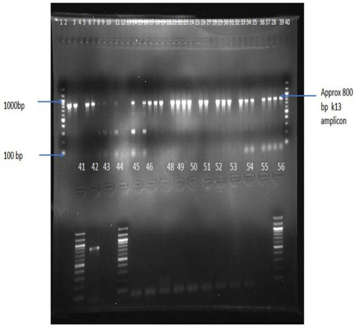 Figure 2 Positive PCR products detected using agarose gel electrophoresis. Wells 1, 40, 41 and 56 contain 100bp DNA ladder; wells 42 and 43 contain positive control (P. falciparum 3d7). The rest of the wells contain samples.