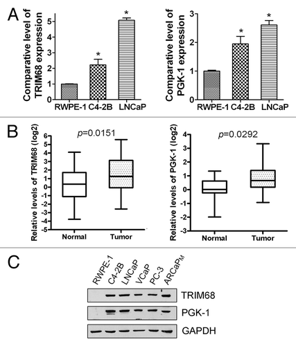 Figure 4. The expression of TRIM68 and PGK-1. A significantly higher mRNA expression of TRIM68 and PGK-1 was observed in PCa cells [(A) *: p < 0.05; n = 3] and in human prostate tumor tissues [(B) n = 46] compared with normal prostate epithelial cells and normal human prostate tissues measured by real-time RT-PCR. A significantly higher expression of TRIM68 and PGK-1 proteins were also observed in PCa cells compared with normal prostate epithelial cells as assessed by Western Blot analysis (C).