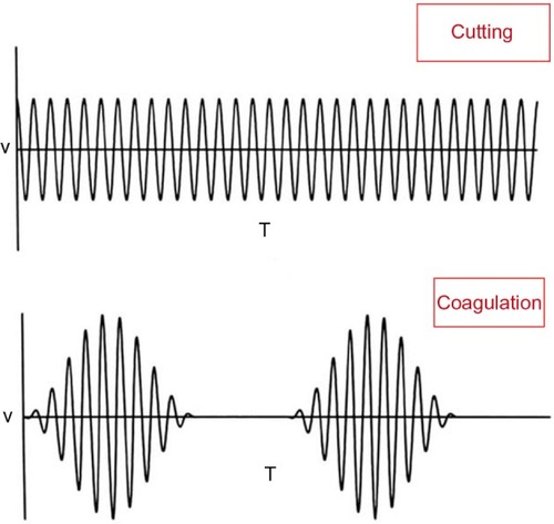 Figure 1 Illustration showing the difference between the cutting mode which is composed of a pure continuous sine wave and the coagulation mode which is composed of intermittent pulses of high voltage current.