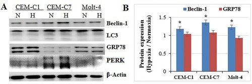 Figure 3. Effects of hypoxia on cell autophagy and ER. All cells were cultured under hypoxic conditions for 48 h. (A) CEM-C1, CEM-C7 and Molt-4, showed an induction in Becline-1 with no alteration in LC3. GRP78 and PERK did not change. (B) Bar graphs show the protein expression ratio of hypoxia to normoxia. *: p<0.05 hypoxia versus normoxia.
