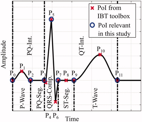Figure 1. Basic constitution of an ECG segment of physiological type with characteristic waves and spikes [Citation4]. The IBT toolbox [Citation10,Citation11] is capable of detecting 12 characteristic points (P0–P11) from which seven are of interest for this study. POI: Points of interest; Int: Interval; Seg: Segment; Comp: Complex.