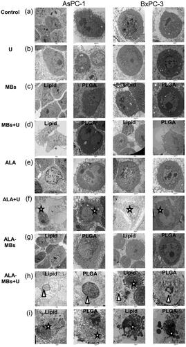 Figure 6. Transmission electron microscopy images of AsPC-1 and BxPC-3 cells. Cells were divided into (a) control group, (b) single ultrasound group (U), (c) lipid/PLGA MBs group, (d) lipid/PLGA MBs + U, (e) single ALA group, (f) ALA + U group, (g) ALA-lipid/PLGA MBs group and (h, i) ALA-lipid/PLGA MBs + U group. Scale bar: 2 mm. White star represented apoptosis, white triangle represented pyroptosis.