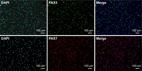 Figure S1 Human skeletal muscle cells were identified by the expression of PAX3 and PAX7.Notes: Primary cultured human skeletal muscle cells have exhibited the expression of PAX3 (green, upper panel) and PAX7 (red, lower panel), which have been known as human myoblast marker. Each of the stained cells was merged with nuclei.