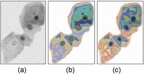 Figure 6. FCM segmentation of the cell clump with clustering category K = 10 and K = 20. (a) The original image. (b) The segmented result with clustering category K = 10. (c) The result with K = 20