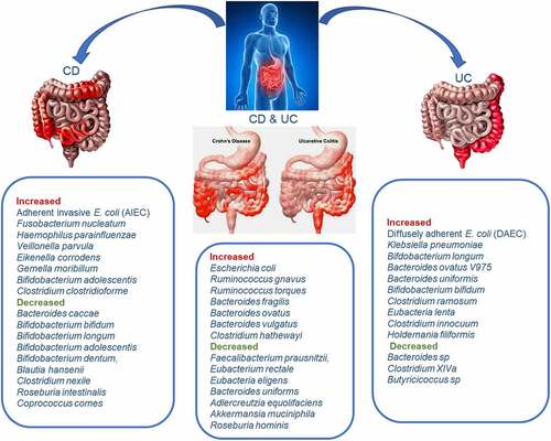 Figure 5. The differential potential of gut bacteria for CD and UC at the species-level. The integration of species level information regarding increases and decreases of specific key dysbiosis-associated bacteria could lead to accurate differentiation of IBD patients from healthy individuals and between the subtypes of IBD (CD from UC). This figure summarizes reported bacteria species increases and decreases in CD, UC, and both types.