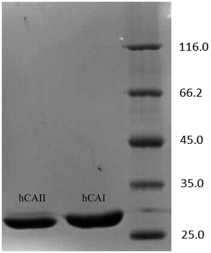 Figure 1. SDS-PAGE pattern. Molecular mass standards: β-galactosidase (116 kDa), bovine serum albumin (66.2 kDa), egg albumin (45.0 kDa), lactate dehydrogenase (35 kDa), REase Bsp981 (Escherichia coli) (25 kDa).