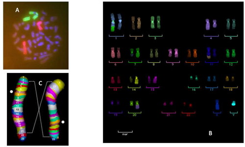 Figure 3. Cytogenetic techniques used to visualize the damage in human peripheral blood lymphocytes in patients during radiotherapy course with either X-rays or C-ion. In the original paper (Durante et al. Citation2000), we used FISH-painting of chromosomes 2 and 4. The panel a shows a dicentric and corresponding acentric fragment involving both chromosomes 2. Later studies involved multi-color FISH (Hartel et al. Citation2010) and mBAND (Pignalosa et al. Citation2013). Translocations involving chromosomes (1,7), (11, 29 and (20,4) are shown in panel B. An inversion in chromosome 2 visualized by mBAND is shown in panel C.