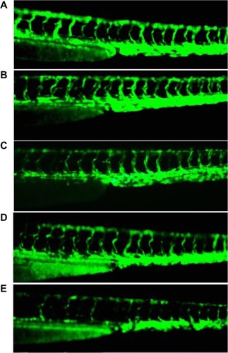 Figure 5 Antiangiogenesis effect of Cur-Dox/MPEG-PCL. Normal embryos (A), embryos treated with empty MPEG-PCL (B), embryos treated with Cur/MPEG-PCL micelles (C), embryos treated with Dox/MPEG-PCL micelles (D), and embryos treated with Cur-Dox/MPEG-PCL micelles (E). Embryos treated with Cur-Dox/MPEG-PCL micelles showing defective vascular formation of variable severity, with intersegmental vessels either sprouting abnormally or failing to form in comparison with control embryos.Abbreviations: Cur, curcumin; Dox, doxorubicin; MPEG, methoxy poly(ethylene glycol); PCL, poly(caprolactone).