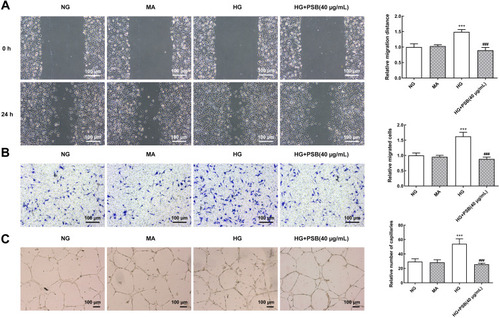 Figure 2 The effect of PSB on HG-stimulated HRVECs migration and angiogenesis. (A) Representative images for wound healing assay. The migration distance was calculated as the width of the scratch at 24 h minus the width of the scratch at 0 h. The relative migration distance was calculated by normalizing to NG group. (B) Representative images for transwell assay. (C) Representative images for tube formation assay. ***P<0.001 vs NG, ###P<0.001 vs HG.