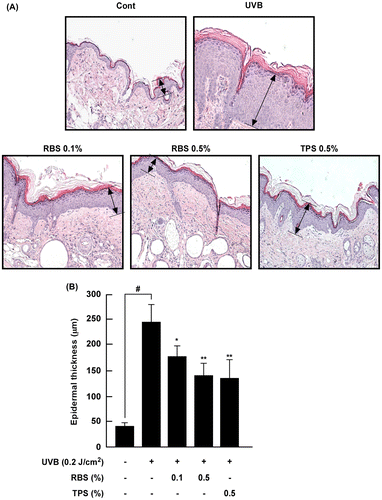 Figure 2. Effect of RBS on UVB-irradiated epidermal thickening in SKH-1 hairless mouse skin. (A) Hematoxylin- and eosin-stained images of UVB-irradiated mouse skin. Images are representative of results from 5 tissue samples. (B) RBS prevents UVB-dependent increases in epidermal thickness. The dorsal skin was excised, sectioned, mounted onto slides, and stained with hematoxylin and eosin for assessment. Results are shown as means ± S.D. (n = 8). The hash symbol (#) indicates a significant difference (p < 0.05) between the control group and the UVB-irradiated group. Asterisks (* and **) indicate a significant difference of p < 0.05 or p < 0.01, respectively, between the RBS diet group and UVB-irradiated group.