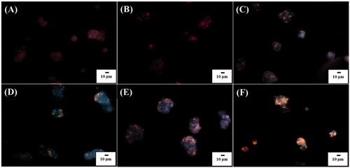 Figure 6. Optical images of Hep G2 cells (1 ml, 106 cells mL−1) under dark field obtained after treated with POA-Au NPs with the concentations of (A) 0, (B) 62.5, (C) 125, (D) 250, (E) 500 and (F) 1000 µgmL−1 for 6 h. Exposure time was set to 40 ms. The scale bar is 10 µm.