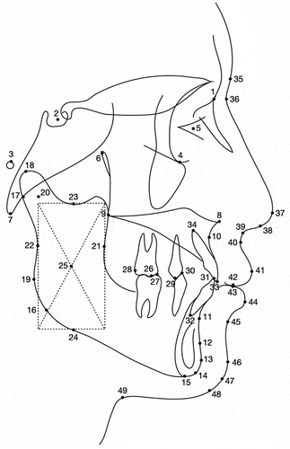 Figure 1. The cephalometric landmarks. 1. Nasion (N), 2. Sella (S), 3. Porion (po), 4. Orbitale (or), 5. Eye point, 6. Pterygomaxillary fissure (pt), 7. Basion (ba), 8. ANS, 9. PNS, 10. A point, 11. B point, 12. PM point, 13. Pogonion (pg), 14. Gnathion (gn), 15. Menton (me), 16. Gonion (go), 17. Articulare (ar), 18. Condylion (co), 19. Ramus point, 20. DC point, 21. R1 the deepest point on the curve of anterior ramus, 22. R2 the point on the posterior ramus, directly behind R1, 23. R3 the centre and most inferior aspect of sigmoid notch, 24. R4 lower border of mandible, directly inferior to R3, 25. Xi point, 26. U6 occlusal, 27. L6 occlusal, 28. U6 distal, 29. U4 cusp tip, 30. L4 cusp tip, 31. L1 tip, 32. L1 root, 33. U1 tip, 34. U1 root, 35. Soft tissue Glabella (G’), 36. Soft tissue Nasion (N’), 37. Pronasale (pn), 38. Columella (cm), 39. Subnasale (sn), 40. Soft tissue subspinale (SLS), 41. Upper lip (ls), 42. Stomion superius (stms), 43. Stomion inferius (stmi), 44. Lower lip (Li), 45. Mentolabial sulcus (ILS), 46. Soft tissue pogonion (pg’), 47. Soft tissue gnathion (gn’), 48. Soft tissue menton (me’), and 49. Throat point.