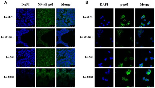 Figure 4 Effects of Ufm1 on NF-κB p65 and p-p65 nuclear translocation in RAW264.7 cells. Immunocytochemical images of NF-κB p65 (A) and p-p65 (B) showing its expression and nuclear translocation in cells treated with LPS and TNF-α for 60 min. LPS: 1000 ng/mL; TNF-α: 20 ng/mL. Green ﬂuorescence indicates localization of the NF-κB p65 or p-p65 subunit, while blue ﬂuorescence indicates nuclear DAPI staining. Magniﬁcation: 400×. Representative images of three independent experiments are shown.