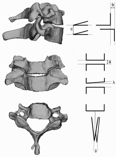 Figure 9. During the simulated surgical operations, the relative positions of the vertebral body upper plates (λ), the height of the individual space in the a.p. projection (a), the distance of the anterior edges of the body in the lateral projection (b), the distance of the spinous processes from each other in the lateral projection (c), and the angular relationship of the spinous processes in the craniocaudal projection (δ) are determined.