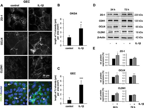 Figure 5. IL-1β increases the expression of OCLN and enhances the formation of TJ stands in gingival keratinocytes.