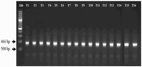 Figure 2. Genomic DNA agarose gel electrophoresis to check the DNA quality (1 kb = ladder; T = treatment).