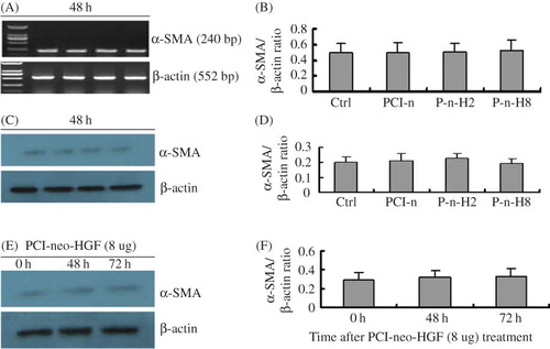 Figure 1.  PCI-neo-HGF transfection has no effect on α-SMA expression in glomerulus mesangial cells. (A) RT-PCR analysis of α-SMA mRNA levels 48 h after transfection. (B) Densitometric analysis of α-SMA mRNA normalized to β-actin. Compared with Ctrl, there was no statistical difference in the groups. (C) Representative Western blot analysis of α-SMA protein level 48 h after transfection. (D) Densitometric analysis of α-SMA protein normalized to β-actin. Compared with Ctrl, there was no statistical difference in the groups. (E) Western blot analysis of α-SMA protein level after transfection with PCI-neo-HGF (8 μg) at the different time points. (F) Densitometric analysis of α-SMA protein normalized to β-actin. Compared with Ctrl, there was no statistical difference at 48 h and 72 h. Ctrl, control; PCI-n, cells + PCI-neo (2 μg); P-n-H2, cells + PCI-neo-HGF (2 μg); and P-n-H8, cells + PCI-neo-HGF (8 μg).