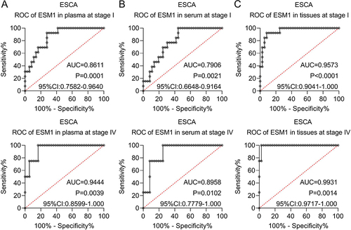 Figure 6 ESM1 might be a sensitive biomarker for the diagnosis of ESCA. The ROC curves of ESM1 at stage I and II in (A) plasma, (B) serum, and (C) tissues in ESCA.
