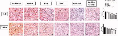 Figure 5. Effects of GPN, MLT, GPN-MLT nanocomplex and marketed formulation on the expression level of (A) IL-6, and (B) TNF-α. a: Significantly different from Untreated control at p < .05, b: Significantly different from Vehicle-treated control at p < .05, c: Significantly different from GPN at p < .05, d: Significantly different from MLT at p < .05.