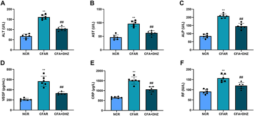 Figure 5 Effect of DHZ on serum (A) ALT, (B) AST, (C) ALP, (D) VEGF, (E) CRP, and (F) RF. Values are expressed as mean ± SD (n = 6), and analyzed by one-way ANOVA followed by Tukey’s multiple comparisons test. For comparison with NCR group: **p<0.05 and comparison with CFAR group: ##p<0.05.