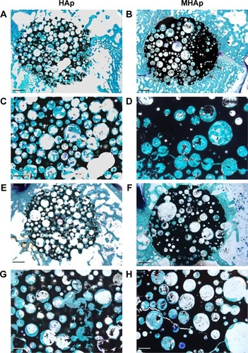 Figure 5 Representative histological views of (A, C, E, and G) HAp and (B, D, F, and H) MHAp scaffolds stained with toluidine blue, acid fuchsin, and fast green at (A–D) 4 and (E–H) 12 weeks from implantation. The low magnification reported in images (A, B, E, and F) allows the displaying of the entire scaffold (dark) and of the implant site. Scale bar is 1 mm in (A, B, E, and F) and 500 mm in (C, D, G, and H). Reproduced from Russo A, Bianchi M, Sartori M, et al. Bone regeneration in a rabbit critical femoral defect by means of magnetic hydroxyapatite macroporous scaffolds. J Biomed Mater Res B Appl Biomater. Epub 2017 Feb 15. Copyright 2017 Wiley.Citation100Abbreviations: HAp, hydroxyapatite; MHAp, magnetic hydroxyapatite.