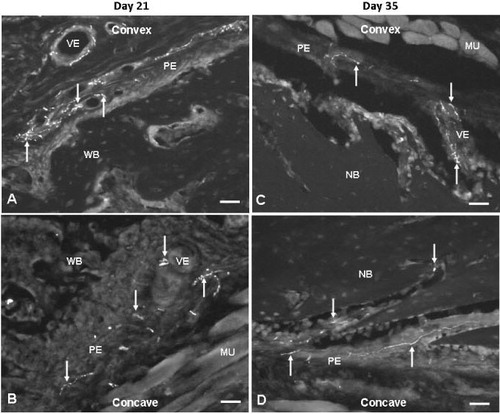 Figure 4. Fluorescence photomicrographs showing site-specific occurrence of NPY fibers on the convex (A and C) and concave (B and D) sides of angulation fractures at days 21 (A and B) and 35 (C and D) after fracture. 20× objective. Bar represents 50 μm. Arrows show NPY fibers. NB: new bone; MU: muscle; PE: periosteum; VE: vessel; WB: woven bone.