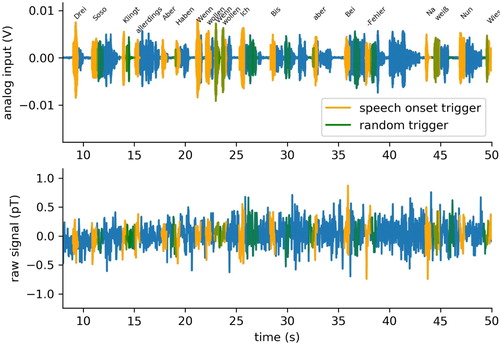 Figure 4. Segmentation of speech stream and MEG signal. After alignment, the continuous wave file (top panel) and multi-channel MEG recordings (bottom panel) are segmented using the time tags from forced alignment as boundaries and labelled with the corresponding types, i.e. words.