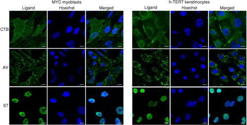 Fig. 7.  Visualization of CTB-, AV- and ST-binding in immortalized human skeletal myoblasts and keratinocytes. Cells were fixed and stained with labelled CTB, AV or ST (green), and counterstained with Hoechst 33342 to visualize the nuclei (blue). Scale bars, 10 µm.