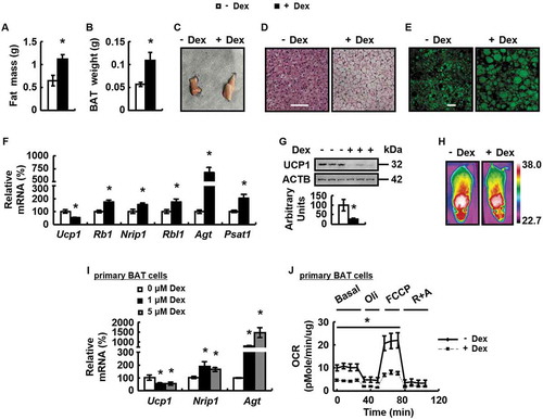 Figure 1. Dex induces BAT whitening in vivo and in vitro. (A-H) Body fat mass (A), BAT weight (B), BAT gross morphology (C), H&E staining of BAT (D), BODIPY staining of BAT (E), mRNA levels of brown adipocyte markers and white adipocyte markers in BAT (F), BAT UCP1 protein levels (G) and infrared images (H) were analyzed in male WT mice i.p. injected with Dex (+ Dex) or PBS (- Dex) for 1 week. (I) mRNA levels of brown adipocyte markers and white adipocyte markers were analyzed in primary cultured brown adipocytes treated with Dex (+ Dex) or PBS (- Dex) for 24 h. (J) OCR was analyzed in primary cultured brown adipocytes treated with Dex (+ Dex) or PBS (- Dex) for 40 min. Reagents oligomycin A (Oli), carbonyl cyanide 4-(trifluoromethoxy) phenylhydrazone (FCCP), rotenone (R) and antimycin A (A) were added sequentially as indicated. Scale bars: 200 μm in D and 20 μm in E. Data are represented as mean ± SEM. Statistical significance was calculated using the two-tailed Student t-test for the effects of with compared to without Dex treatment (*: p < 0.05) in A, B, F, G, I and J.