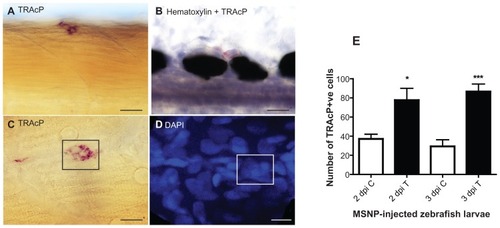 Figure 6 (A) Tartrate-resistant acid phosphatase (TRAcP) expression in the somites of a 3 days post injection larva with apparently multinuclear cell. (B) TRAcP+ cells counterstained with hematoxylin. (C) TRAcP+ zebrafish larva showing apparently multinuclear cells (box). (D) TRAcP enzyme-stained larva counterstained with 4′,6-diamidino-2-phenylindole (DAPI) showing five to six nuclei same area as C (box). Scale bar ABC = 12.5 μm and D = 12 μm. (E) Quantitative analysis of TRAcP+ cells at 2 days post injection (dpi) and 3 dpi. Ten larvae/group were used to quantify the number of TRAcP+ cells. Statistical analysis was done with one-way analysis of variance.Notes: *P < 0.1; ***P < 0.001. “C” means control (ie, phosphate-buffered-saline injected) and “T” means treated (ie, protein-loaded-MSNP injected).