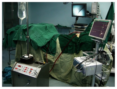 Figure 2 The hyperthermic perfusion system during surgery.