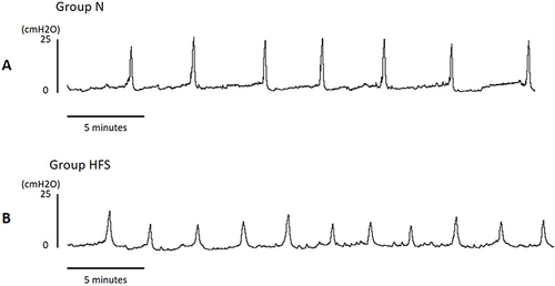 Figure 1 Representative cystometry traces in a rat fed on normal diet (A) and HFS diet (B). Compared with normal diet rat, the intercontraction interval was shorter and voiding pressure lower in HFS diet rat.