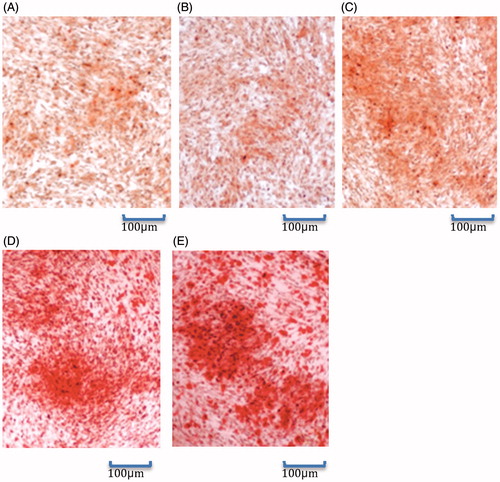 Figure 6. Alizarin red staining results (100×). (A): Control group; (B): Ad-null group; (C): Ad-VEGF165 group; (D): Ad-BMP-2 group; (E): Ad-VEGF165 + Ad-BMP2 group.