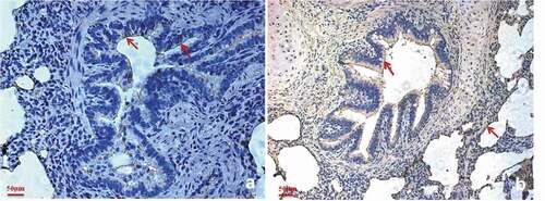 Figure 6. Factor H is predominantly present in the M. hyopneumoniae colonization site.