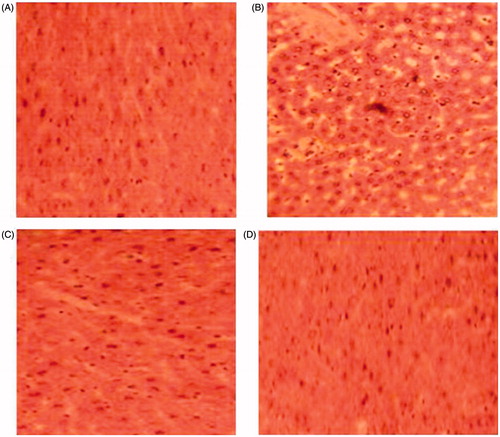 Figure 4. Histopathological studies of liver in control (A), high-cholesterol fed (B), green tea-supplemented rats (C), and kombucha-supplemented rats (D) (hematoxylin–eosin, H&E staining, 100×).