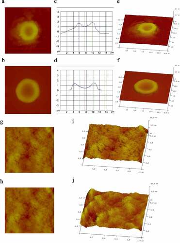 Figure 3. Erythrocyte morphology. a and b are images of a single erythrocyte in healthy controls and patients, respectively; c and d are altitude profiles of a single erythrocyte in healthy controls and patients, respectively; e and f are 3D models of the single erythrocyte in panels a and b, respectively; g and h are images of the surface membrane of a single erythrocyte in healthy controls and patients, respectively; i and j are the ultrastructures of the membrane of the erythrocyte in panels a and b, respectively